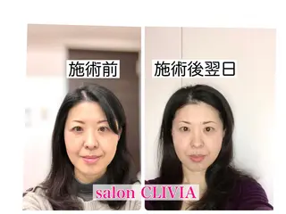 salon CLIVIA, クリヴィア所属・無痛小顔矯正 クリヴィアのエステ・リラクイメージ