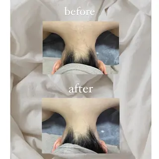 crescent所属・【韓国肌管理・脱毛】 クレセントのエステ・リラクイメージ