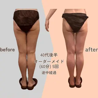 痩身エステ Julien麹町店のエステ・リラクイメージ