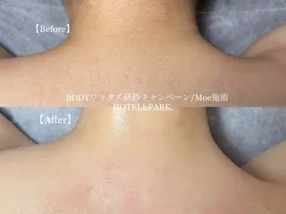 HOTEL&PARK . ワックス脱毛のエステ・リラクイメージ