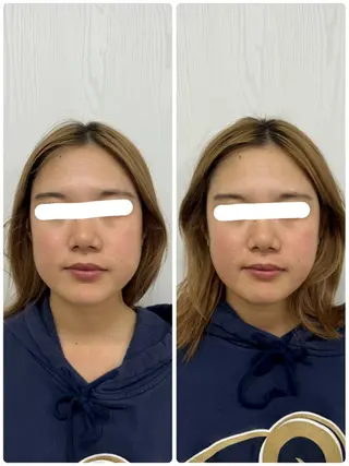 美容鍼×小顔矯正 ×美容整体 浜川泰仁のエステ・リラクイメージ