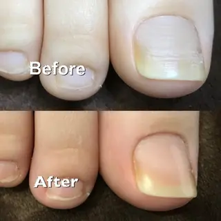 ENSIA エンシアのネイルデザイン