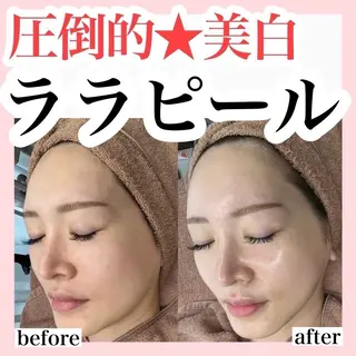 ハーブピーリング/ ララピール専門店のエステ・リラクイメージ