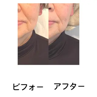 おうちサロン B-ROOMのエステ・リラクイメージ