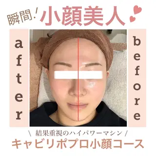 エステサロン JURISのエステ・リラクイメージ