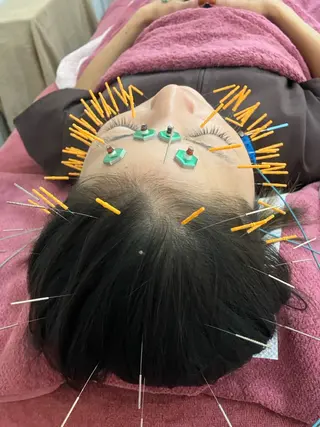 美容鍼灸女性専用 りんご鍼灸治療院のその他イメージ