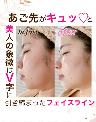 オーダーメイドエステ　ソワンドビジュー所属・美肌×小顔専門/ 亀澤いずみのエステ・リラクイメージ