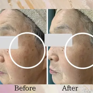 Lumiere despoir所属・Lumiere despoirのエステ・リラクイメージ