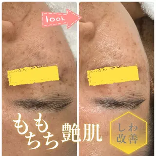 フェイシャルサロン ビアンカガーデンのエステ・リラクイメージ