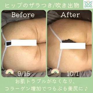 剥離するハーブ🌈 Honey Sideのエステ・リラクイメージ