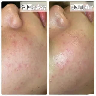 BEAUTY SALON R's所属・BEAUTY SALON R'sのエステ・リラクイメージ