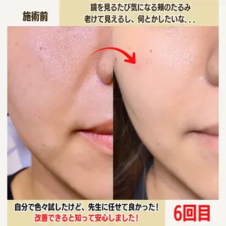 経堂鍼灸整体院 古木のエステ・リラクイメージ