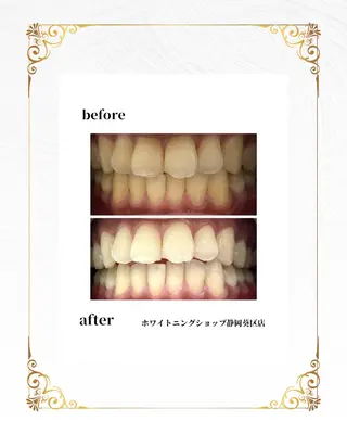 ホワイトニングショップ静岡葵区店所属・ホワイトニング ショップ静岡葵区店のその他イメージ