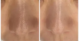 エステサロン Libertaのその他イメージ