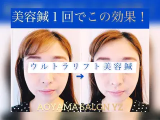小顔美容鍼専門サロン 渋谷YZのエステ・リラクイメージ