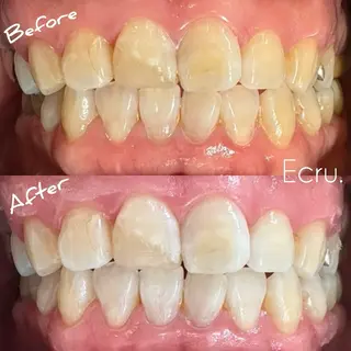 メンズ キッズ ホワイトニングサロン Ecru所属・ホワイトニングサロン Ecru エクリュのその他イメージ