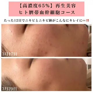 Bellesthe （ベルエステ）のエステ・リラクイメージ