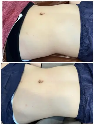 FLEUR大阪・整体 ・ハイフ・痩身・小顔のエステ・リラクイメージ