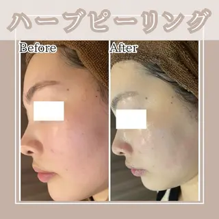 メンズ Amaryllis 🌹松本のエステ・リラクイメージ