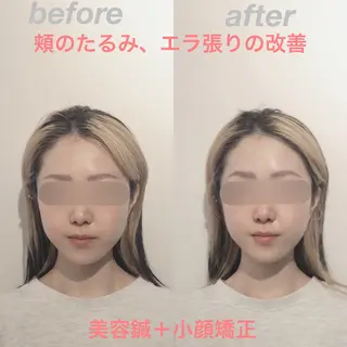 経堂鍼灸整体院 古木のエステ・リラクイメージ
