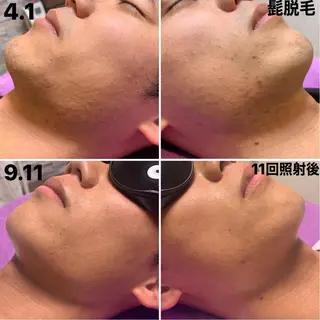 メンズ 脱毛＆エステサロン【アンリミット】所属・森谷 莉美のエステ・リラクイメージ