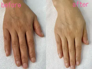 Nature Souce毛穴専門店のその他イメージ