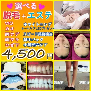 ニキビ・ 肌荒れ専門店のエステ・リラクイメージ