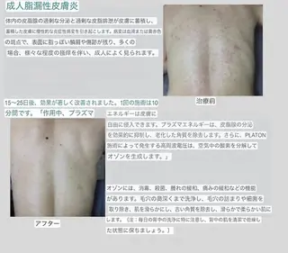 メンズ セルフエステ ALL in ONE所属・1組貸切 セルフエステのエステ・リラクイメージ