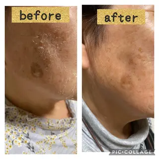 マツエク・マツパ アイブロウ total beauty  salon RIRE所属・古川 弥生のエステ・リラクイメージ