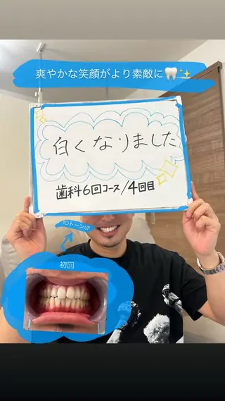 歯のセルフホワイトニング専門店GLOW（グロウ）所属・東区香椎歯のセルフホ ワイトニングGLOWのその他イメージ
