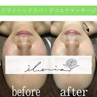 心斎橋痩身ダイエット 韓国.美容鍼.小顔のエステ・リラクイメージ