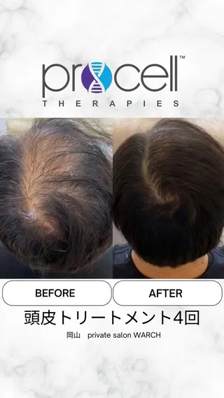 WARCH Marieのその他イメージ