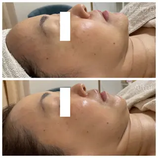 髪/まつげ/眉/毛穴 ハーブ/他/AIKOのその他イメージ