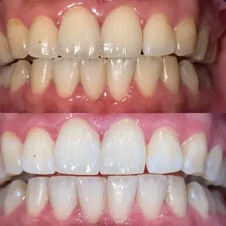 ホワイトニングサロンaile所属・セルフホワイトニング 金城しおりのその他イメージ