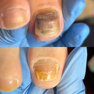 ネイル Cure.美爪育成 salon 岡澤のネイルデザイン