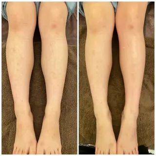 美PLACE所属・m oecaのエステ・リラクイメージ