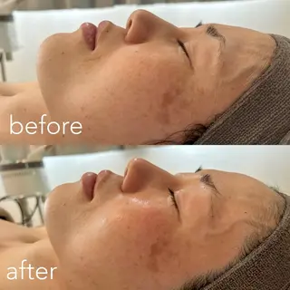 エステティックサロン Liente(リアンテ)所属・Hashimoto .のエステ・リラクイメージ