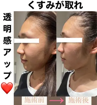 脱毛&美容サロンBLUESEA所属・脱毛&美容サロン BLUESEAのエステ・リラクイメージ
