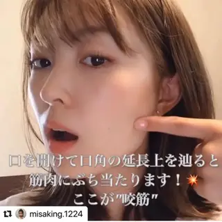 鍼灸整骨院Refine所属・鍼灸 Refineのその他イメージ