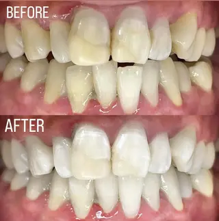 LBSホワイトニング 銀座店💎店長浦和のその他イメージ