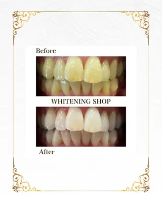 ホワイトニングショップ静岡葵区店所属・ホワイトニング ショップ静岡葵区店のその他イメージ