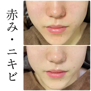 ハーブピーリング専門 BIOEL横浜のエステ・リラクイメージ