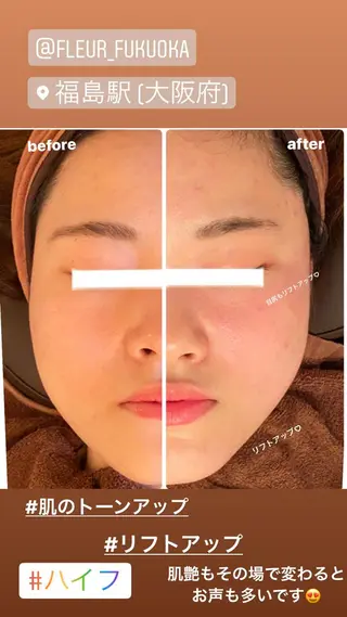 FLEUR大阪・整体 ・ハイフ・痩身・小顔のエステ・リラクイメージ