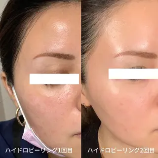 メンズ salonLADYSTYLE所属・稲嶺 美華のエステ・リラクイメージ