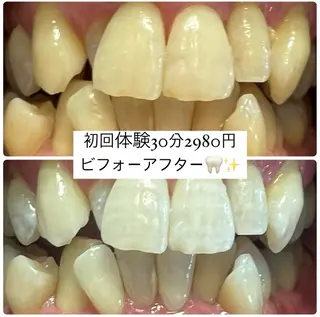 PLATINUM Beauty 横浜店所属・ホワイトニングルーム 横浜店のその他イメージ