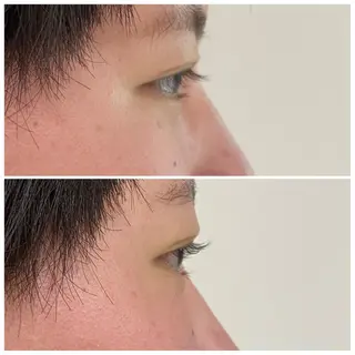 マツエク・マツパ I's hair NUBOU所属・小守林 蘭のヘアスタイル