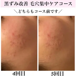 Bellesthe (ベルエステ)のエステ・リラクイメージ