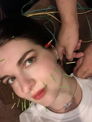 メンズ 美容鍼灸サロン LOMIHARIのエステ・リラクイメージ