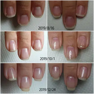 ネイル Jeliss~美爪育成ネイル＆頭蓋骨小顔矯正サロン~所属・美顔(小顔)矯正& 美爪育成Jelissのエステ・リラクイメージ