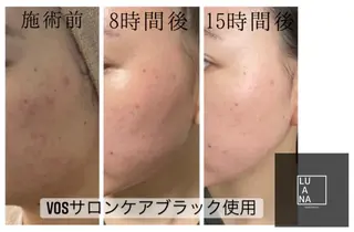 LUANA TAKAGIの眉毛・アイブロウイメージ